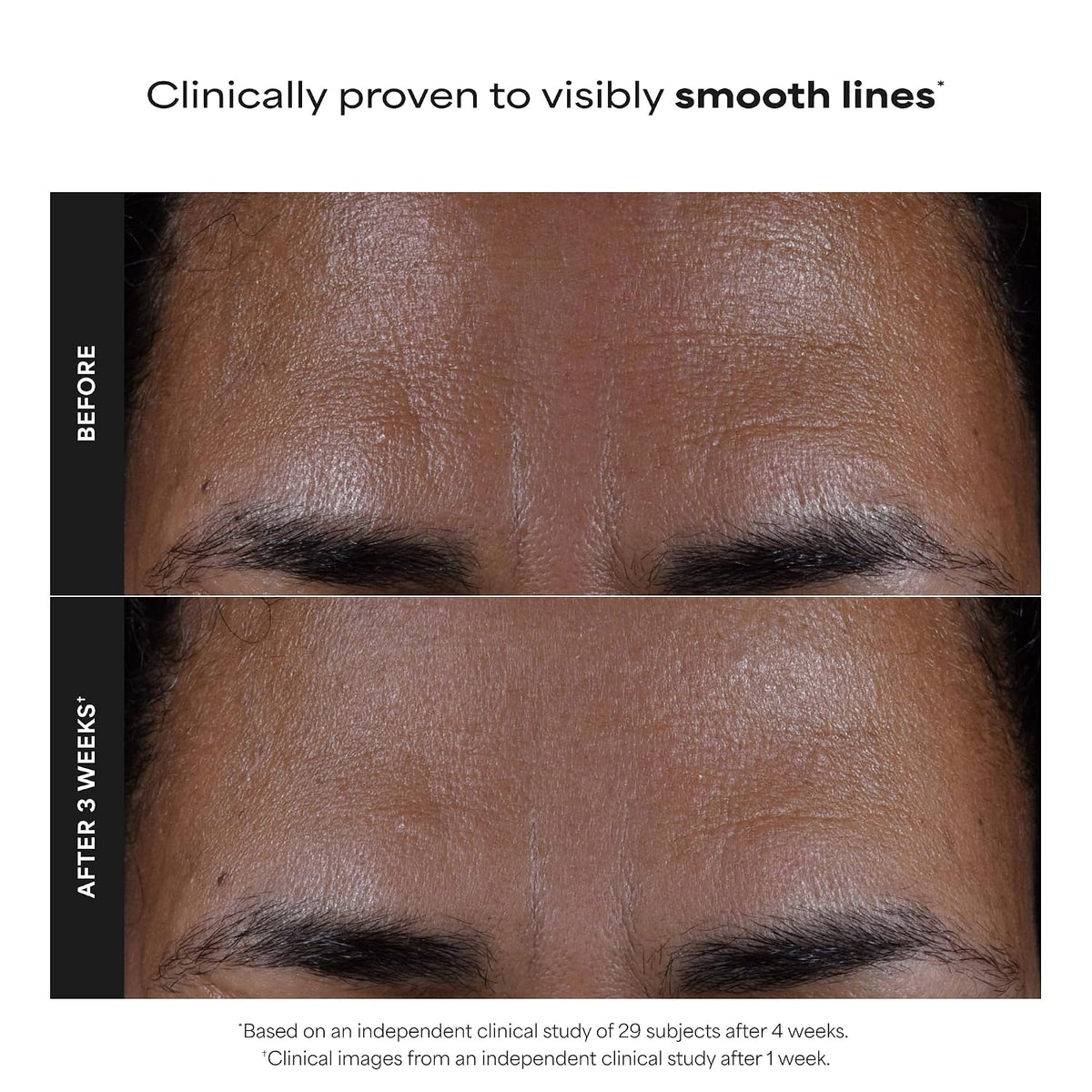 Revitalize Your Skin with Paula's Choice SKIN PERFECTING 2% BHA Liquid Leave-On Exfoliant - For Unclogged Pores and Youthful Glow
